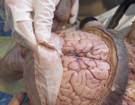 Brain Dissection: Dissection of the Brain and Spinal Cord (BD)